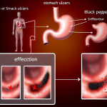 is black pepper bad for ulcers