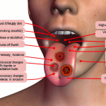 what causes dead taste buds